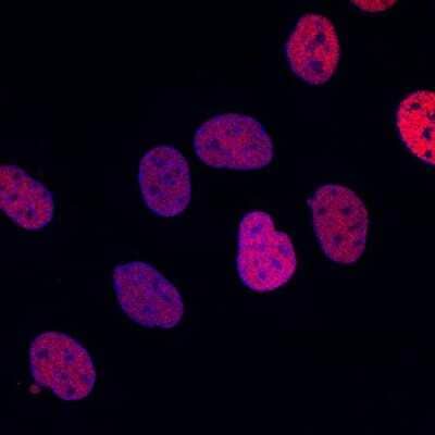 Immunocytochemistry/Immunofluorescence: PAX8 Antibody (SD0832) [NBP2-67793] - Usage of PAX8 antibody in ICC of SKOV3 cells (positive control)