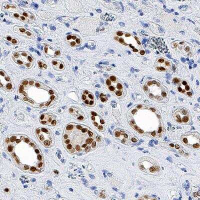 Immunohistochemistry: PAX8 Antibody (SD0832) [NBP2-67793] - Usage of PAX8 antibody in IHC of human kidney cells