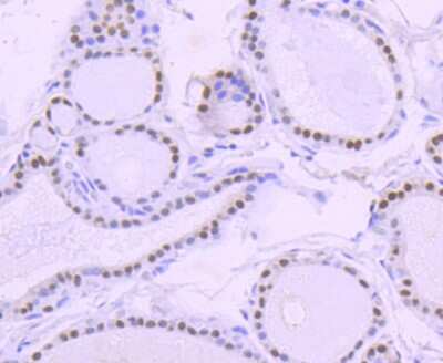 Immunohistochemistry-Paraffin: PAX8 Antibody (SD0832) [NBP2-67793] - Analysis of paraffin-embedded human thyroid tissue using anti-PAX8 antibody. Counter stained with hematoxylin.