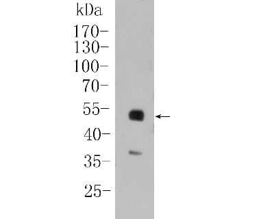 Western Blot: PAX8 Antibody (SD0832) [NBP2-67793] - Western blot analysis of PAX8 on SKOV-3 cell lysate. Proteins were transferred to a PVDF membrane and blocked with 5% BSA in PBS for 1 hour at room temperature. The primary antibody (1/500) was used in 5% BSA at room temperature for 2 hours. Goat Anti-Rab