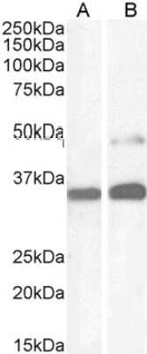 Western Blot: PAX8 Antibody [NB100-1065] - Staining of Human Kidney (A) and HeLa cell (B) lysate (35 ug protein in RIPA buffer). Antibody at 1 ug/mL. Detected by chemiluminescence.