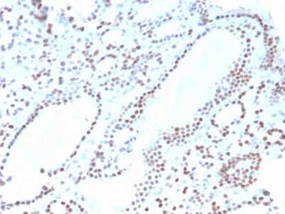 Immunohistochemistry-Paraffin: PAX8 Antibody (ZR-1) - Azide and BSA Free [NBP3-08307] - Formalin-fixed, paraffin-embedded human thyroid stained with PAX8 Recombinant Rabbit Monoclonal Antibody (ZR-1).