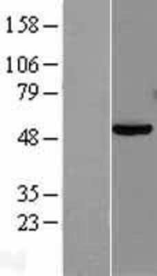 Western Blot: PAX8 Overexpression Lysate (Adult Normal) [NBL1-14132] Left-Empty vector transfected control cell lysate (HEK293 cell lysate); Right -Over-expression Lysate for PAX8.