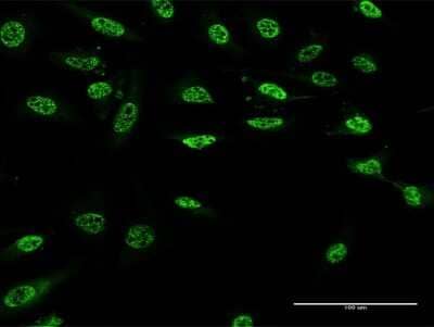 Immunocytochemistry/Immunofluorescence: PAX9 Antibody (3B8) [H00005083-M13] - Analysis of monoclonal antibody to PAX9 on HeLa cell. Antibody concentration 5 ug/ml