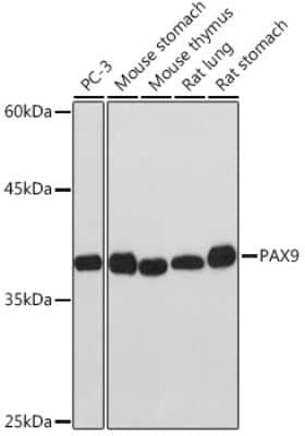 Western Blot: PAX9 Antibody (3C2U5) [NBP3-15888] - Analysis of extracts of various cell lines, using PAX9 Rabbit mAb (NBP3-15888) at 1:1000 dilution. Secondary antibody: HRP Goat Anti-Rabbit IgG (H+L) at 1:10000 dilution. Lysates/proteins: 25ug per lane. Blocking buffer: 3% nonfat dry milk in TBST. Detection: ECL Basic Kit. Exposure time: 10s.