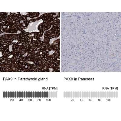 Immunohistochemistry-Paraffin: PAX9 Antibody [NBP1-89481] - Staining in human parathyroid gland and pancreas tissues using anti-PAX9 antibody. Corresponding PAX9 RNA-seq data are presented for the same tissues.