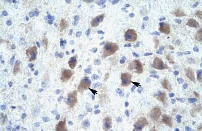 Immunohistochemistry-Paraffin: PAX9 Antibody [NBP3-10316] - Immunohistochemical analysis of paraffin-embedded human brain tissue.