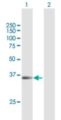 Western Blot: PAX9 Antibody [H00005083-B01P] - Analysis of PAX9 expression in transfected 293T cell line by PAX9 polyclonal antibody.  Lane 1: PAX9 transfected lysate(37.51 KDa). Lane 2: Non-transfected lysate.