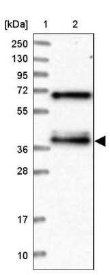 Western Blot: PAX9 Antibody [NBP1-89481] - Lane 1: Marker  [kDa] 250, 130, 95, 72, 55, 36, 28, 17, 10.  Lane 2: Human cell line RT-4