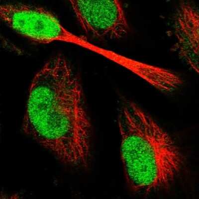 Immunocytochemistry/Immunofluorescence: PAXX Antibody [NBP1-94172] - Immunofluorescent staining of human cell line U-251 MG shows localization to nucleoplasm.