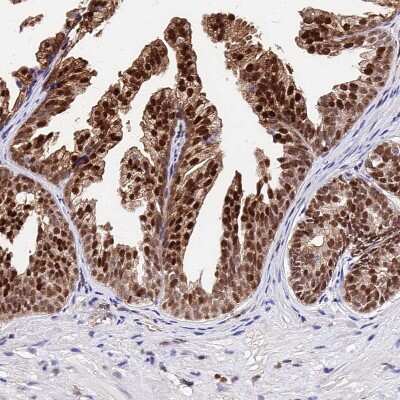 Immunohistochemistry-Paraffin: PAXX Antibody [NBP1-94172] - Staining of human prostate shows strong nuclear positivity in glandular cells.