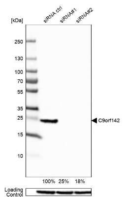 Western Blot: PAXX Antibody [NBP1-94172] - Analysis in HEK293 cells transfected with control siRNA, target specific siRNA probe #1 and #2, using anti-C9orf142 antibody. Remaining relative intensity is presented. Loading control: anti-GAPDH.