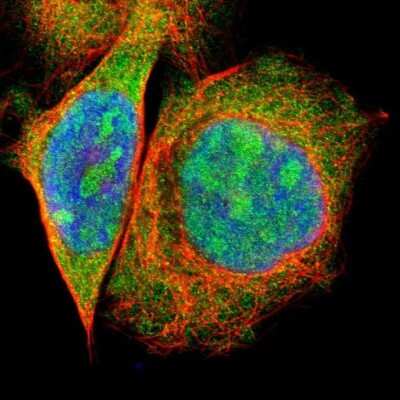 Immunocytochemistry/Immunofluorescence: PBDC1 Antibody [NBP1-82657] - Staining of human cell line A-431 shows positivity in nucleus, nucleoli and cytoplasm.