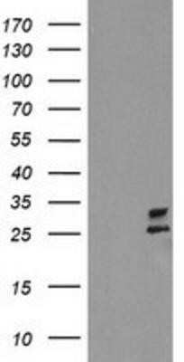 Western Blot: PBDC1 Antibody (OTI4E11) - Azide and BSA Free [NBP2-71912] - HEK293T cells were transfected with the pCMV6-ENTRY control (Left lane) or pCMV6-ENTRY CXorf26 (Right lane) cDNA for 48 hrs and lysed. Equivalent amounts of cell lysates (5 ug per lane) were separated by SDS-PAGE and immunoblotted with anti-CXorf26.