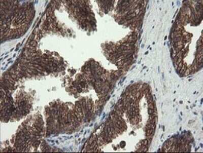 Immunohistochemistry: PBDC1 Antibody (OTI5A11) - Azide and BSA Free [NBP2-71911] - Analysis of Human prostate tissue.