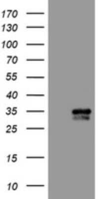 Western Blot: PBDC1 Antibody (OTI5A11) - Azide and BSA Free [NBP2-71911] - Analysis of HEK293T cells were transfected with the pCMV6-ENTRY control (Left lane) or pCMV6-ENTRY CXorf26.