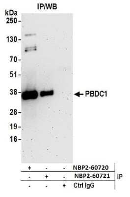 Western Blot: PBDC1 Antibody [NBP2-60720] - Detection of human PBDC1 by western blot of immunoprecipitates. Samples: Whole cell lysate (0.5 or 1.0 mg per IP reaction; 20% of IP loaded) from 293T cells prepared using NETN lysis buffer. Antibodies: Affinity purified rabbit anti-PBDC1 antibody NBP2-60720 used for IP at 20 ul per reaction. PBDC1 was also immunoprecipitated by rabbit anti-PBDC1 antibody NBP2-60721. For blotting immunoprecipitated PBDC1, NBP2-60720 was used at 1:250. Detection: Chemiluminescence with an exposure time of 3 minutes.