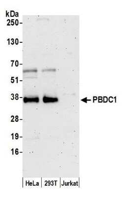 Western Blot: PBDC1 Antibody [NBP2-60721] - Detection of human PBDC1 by western blot. Samples: Whole cell lysate (15 ug) from HeLa, 293T, and Jurkat cells prepared using NETN lysis buffer. Antibody: Affinity purified rabbit anti-PBDC1 antibody NBP2-60721 used for WB at 1:1000. Detection: Chemiluminescence with an exposure time of 3 minutes.Previous