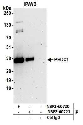 Western Blot: PBDC1 Antibody [NBP2-60721] - Detection of human PBDC1 by western blot of immunoprecipitates. Samples: Whole cell lysate (0.5 or 1.0 mg per IP reaction; 20% of IP loaded) from 293T cells prepared using NETN lysis buffer. Antibodies: Affinity purified rabbit anti-PBDC1 antibody NBP2-60721 used for IP at 20 ul per reaction. PBDC1 was also immunoprecipitated by rabbit anti-PBDC1 antibody NBP2-60720. For blotting immunoprecipitated PBDC1, NBP2-60721 was used at 1:250. Detection: Chemiluminescence with an exposure time of 3 minutes.