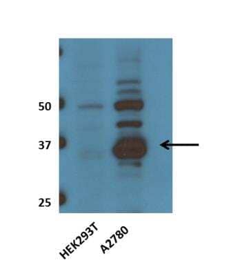 Western Blot: PBEF/Visfatin/NAMPT Antibody [NBP2-23795] - DETECTS A STRONG BAND AROUND 37Kda AND ALSO THE OTHER ISOFORMS BETWEEN 40 AND 55Kda. THE DILUTION OF THE ANTIBODY CAN BE ENHANCED  1:5000. Image from a verified customer review.