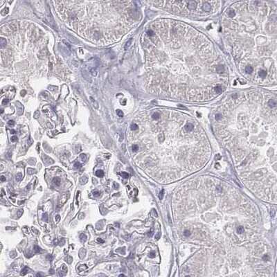 Immunohistochemistry-Paraffin: PBK Antibody [NBP1-84342] - Staining of human kidney.