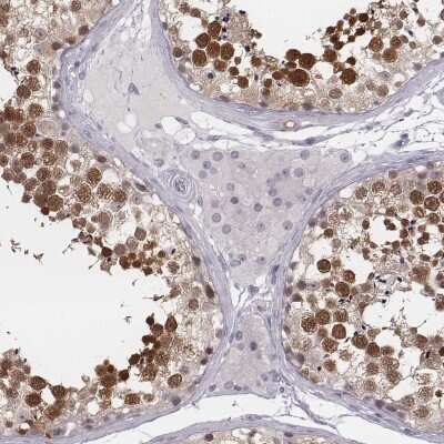Immunohistochemistry-Paraffin: PBK Antibody [NBP2-58043] - Staining of human testis shows high expression.