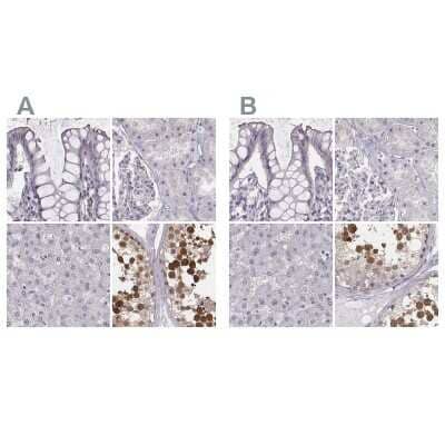 <b>Independent Antibodies Validation. </b>Immunohistochemistry-Paraffin: PBK Antibody [NBP2-58043] - Staining of human colon, kidney, liver and testis using Anti-PBK antibody NBP2-58043 (A) shows similar protein distribution across tissues to independent antibody NBP1-84342 (B).