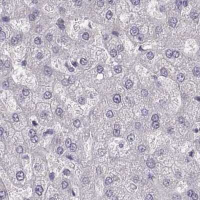Immunohistochemistry-Paraffin: PBK Antibody [NBP2-58043] - Staining of human liver.
