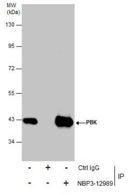 Immunoprecipitation: PBK Antibody [NBP3-12989] - Immunoprecipitation of PBK protein from A431 whole cell extracts using 5 ug of PBK antibody (NBP3-12989). Western blot analysis was performed using PBK antibody (NBP3-12989) diluted at 1:500. EasyBlot anti-Rabbit IgG was used as a secondary reagent.