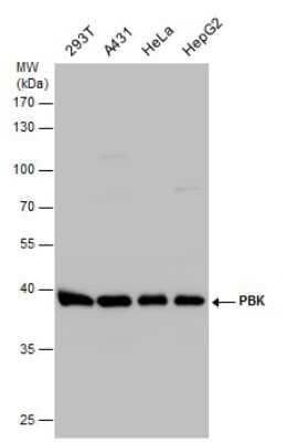 Western Blot: PBK Antibody [NBP3-12989] - PBK antibody detects PBK protein by western blot analysis. Various whole cell extracts (30 ug) were separated by 10% SDS-PAGE, and the membrane was blotted with PBK antibody (NBP3-12989) diluted at 1:1000.