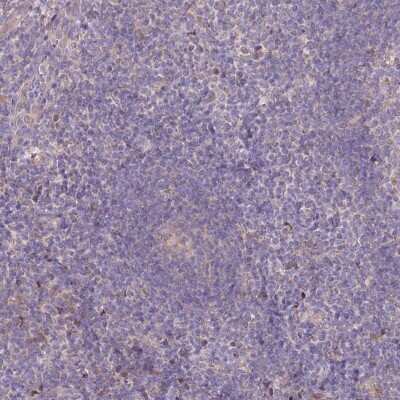 Immunohistochemistry-Paraffin PBLD Antibody