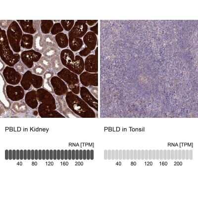 Immunohistochemistry-Paraffin PBLD Antibody