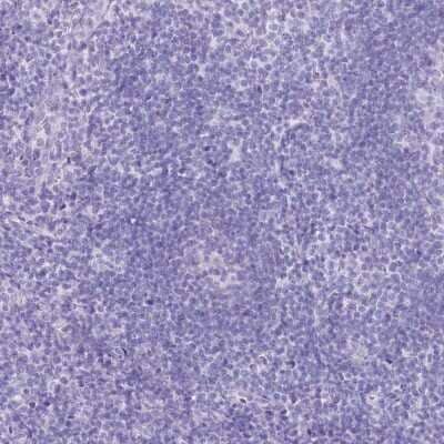 Immunohistochemistry-Paraffin: PBLD Antibody [NBP1-83683] - Staining of human tonsil shows low expression as expected.