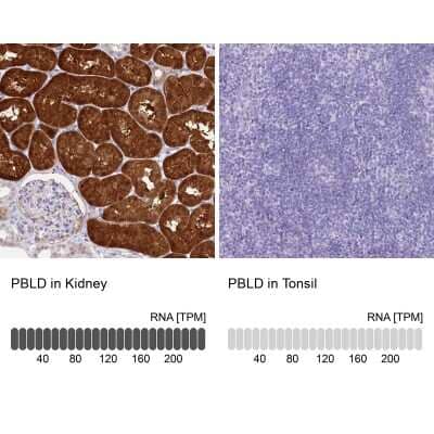 <b>Orthogonal Strategies Validation. </b>Immunohistochemistry-Paraffin: PBLD Antibody [NBP1-83683] - Staining in human kidney and tonsil tissues using anti-PBLD antibody. Corresponding PBLD RNA-seq data are presented for the same tissues.