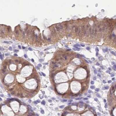 Immunohistochemistry-Paraffin: PBLD Antibody [NBP1-83683] - Staining of human colon.