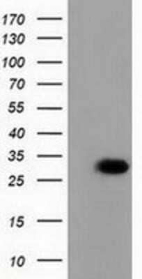 Western Blot: PBLD Antibody (OTI7G5) - Azide and BSA Free [NBP2-73262] - HEK293T cells were transfected with the pCMV6-ENTRY control (Left lane) or pCMV6-ENTRY PBLD (Right lane) cDNA for 48 hrs and lysed. Equivalent amounts of cell lysates (5 ug per lane) were separated by SDS-PAGE and immunoblotted with anti-PBLD.