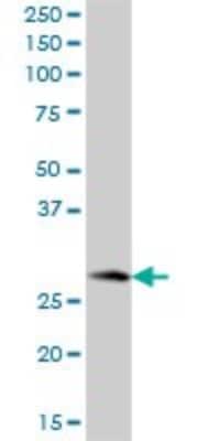 Western Blot: PBLD Antibody [H00064081-B01P] - Analysis of MAWBP expression in human liver.