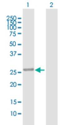 Western Blot: PBLD Antibody [H00064081-B01P] - Analysis of PBLD expression in transfected 293T cell line by PBLD polyclonal antibody.  Lane 1: MAWBP transfected lysate(31.68 KDa). Lane 2: Non-transfected lysate.