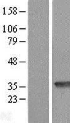 Western Blot: PBLD Overexpression Lysate (Adult Normal) [NBL1-14136] Left-Empty vector transfected control cell lysate (HEK293 cell lysate); Right -Over-expression Lysate for PBLD.
