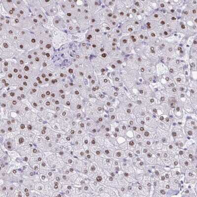 Immunohistochemistry: PBOV1 Antibody [NBP2-38982] - Staining of human liver shows moderate nuclear positivity in hepatocytes.