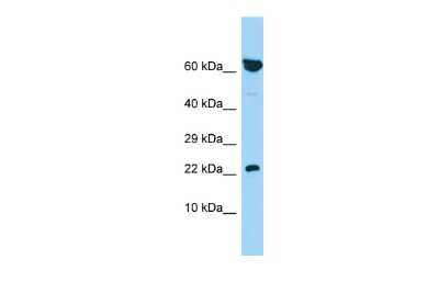 Western Blot: PBOV1 Antibody [NBP2-83367] - Host: Rabbit. Target Name: PBOV1. Sample Type: 721_B Whole Cell lysates. Antibody Dilution: 1.0ug/mlPBOV1 is supported by BioGPS gene expression data to be expressed in 721_B