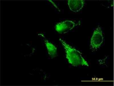 Immunocytochemistry/Immunofluorescence: PBR Antibody [H00000706-B01P] - Immunofluorescence of purified MaxPab antibody to BZRP on HeLa cell. [antibody concentration 10 ug/ml]