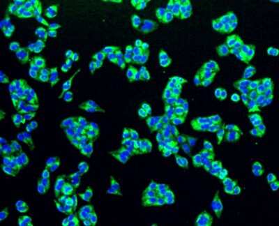 Immunocytochemistry/Immunofluorescence: PBR Antibody (SA90-03) [NBP2-67293] - Staining PBR in Hela cells (green). The nuclear counter stain is DAPI (blue). Cells were fixed in paraformaldehyde, permeabilised with 0.25% Triton X100/PBS.