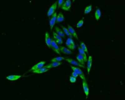 Immunocytochemistry/Immunofluorescence: PBR Antibody (SA90-03) [NBP2-67293] - ICC staining of PBR in PC-3M cells (green). Formalin fixed cells were permeabilized with 0.1% Triton X-100 in TBS for 10 minutes at room temperature and blocked with 1% Blocker BSA for 15 minutes at room temperature. Cells were probed with the primary ant