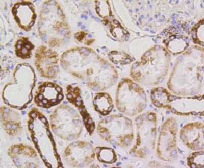 Immunohistochemistry-Paraffin: PBR Antibody (SA90-03) [NBP2-67293] - Analysis of paraffin-embedded human kidney tissue using anti-PBR antibody. Counter stained with hematoxylin.
