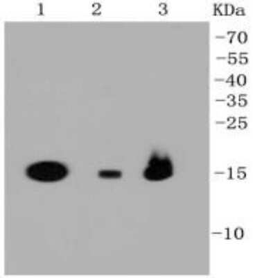 Western Blot: PBR Antibody (SA90-03) [NBP2-67293] - Analysis of PBR on different cell lysates using anti-PBR antibody at 1/1,000 dilution. Positive control: Lane 1: 293T Lane 2: NIH/3T3 Lane 3: HepG2