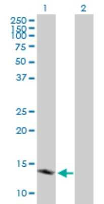 Western Blot: PBR Antibody [H00000706-B01P] - Analysis of TSPO expression in transfected 293T cell line by TSPO polyclonal antibody.  Lane 1: BZRP transfected lysate(18.59 KDa). Lane 2: Non-transfected lysate.