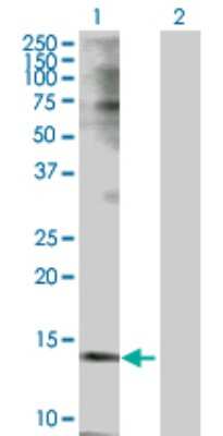 Western Blot: PBR Antibody [H00000706-D01P] - Analysis of TSPO expression in transfected 293T cell line by TSPO polyclonal antibody.Lane 1: TSPO transfected lysate(18.80 KDa).Lane 2: Non-transfected lysate.