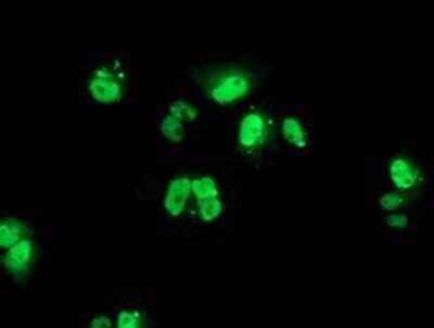 Immunocytochemistry/Immunofluorescence: PBX1 Antibody (OTI1C11) - Azide and BSA Free [NBP2-73265] - Staining of COS7 cells transiently transfected by pCMV6-ENTRY PBX1.