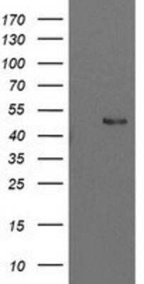 Western Blot: PBX1 Antibody (OTI1C11) - Azide and BSA Free [NBP2-73265] - HEK293T cells were transfected with the pCMV6-ENTRY control (Left lane) or pCMV6-ENTRY PBX1 (Right lane) cDNA for 48 hrs and lysed. Equivalent amounts of cell lysates (5 ug per lane) were separated by SDS-PAGE and immunoblotted with anti-PBX1.